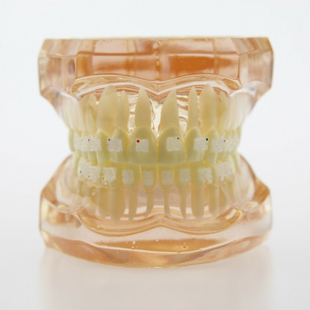 YZDKJDZ Modèle De Dents, Modèle De Dent Orale Orthodontique avec 32 Dents  Amovibles, Modèle De Gencive Molle pour Typodont, pour Démonstration De